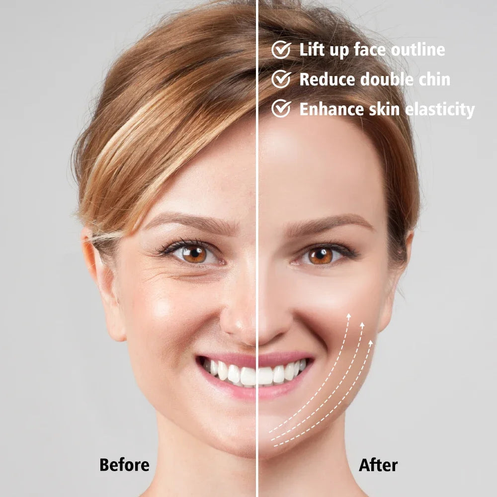 EMS Face Lifting Device – LED Photon Therapy & Vibration Technology